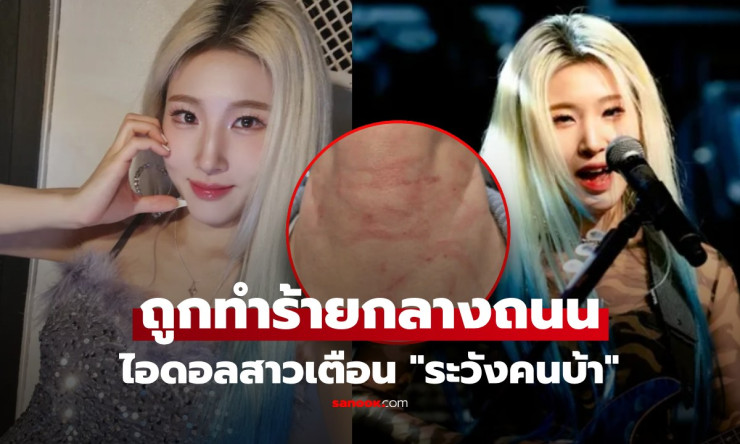 ช็อกสุดขีด! ไอดอลร็อกสาวเกาหลี โดนตีหน้า-คอเลือดอาบกลางถนน โพสต์เตือน ระวังคนบ้า แฟนกรี๊ดแตก!