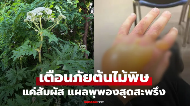 สะพรึง! ต้นไม้พิษ พืชดอกสวยสุดอันตราย แค่พลาดสัมผัสก็แผลพุพอง บวมทั้งมือ