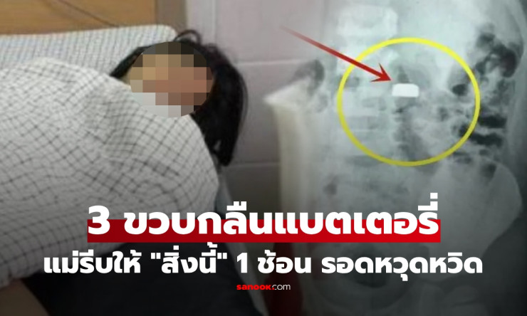 เด็ก 3 ขวบกลืนแบตเตอรี่กระดุม แม่รีบให้กิน น้ำผึ้ง 1 ช้อน หมอชมตัดสินใจถูกมาก!