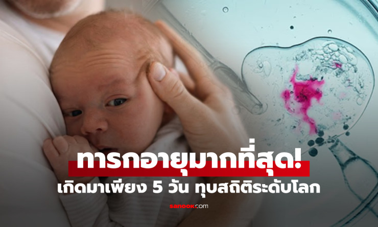 เด็กชายวัย 5 วัน กลายเป็นทารกที่อายุมากที่สุดในโลก จากปาฏิหาริย์ทางการแพทย์