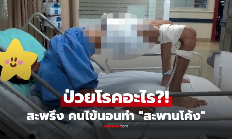 ท่าสะพานโค้งที่ชวนขนลุก: โรคบาดทะยักอันตรายที่อาจเกิดขึ้นกับตัวคุณ!