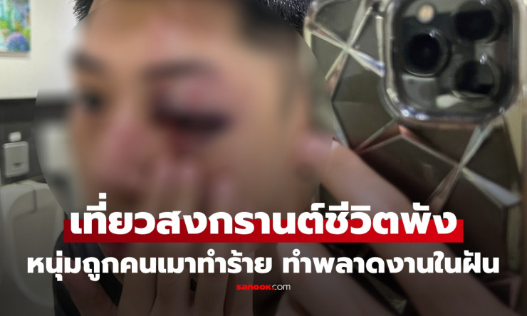 เที่ยวสงกรานต์ครั้งเดียว ชีวิตพัง! หนุ่ม 27 ปีร่ำไห้ถูกคนเมาต่อยตาแตก พลาดงานในฝัน